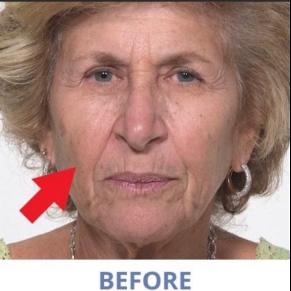 Fast Acting Eye Serum, Tint & Tighten (5) - Picture 3 of 15